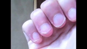 Compilation Où Je Ronge Mes Ongles En 2014 (1) Nails Biting Compilation